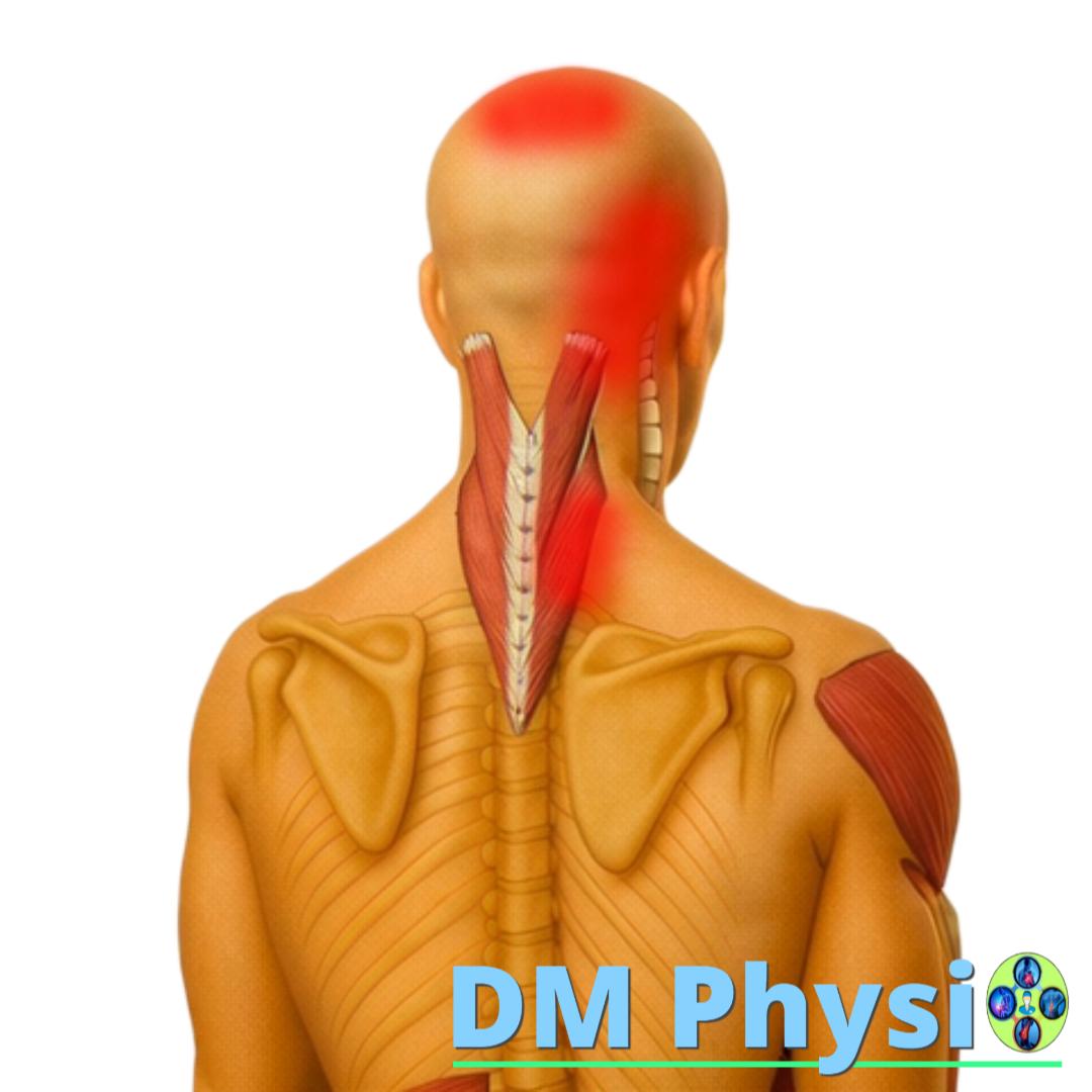 Изображение на мускулите splenius